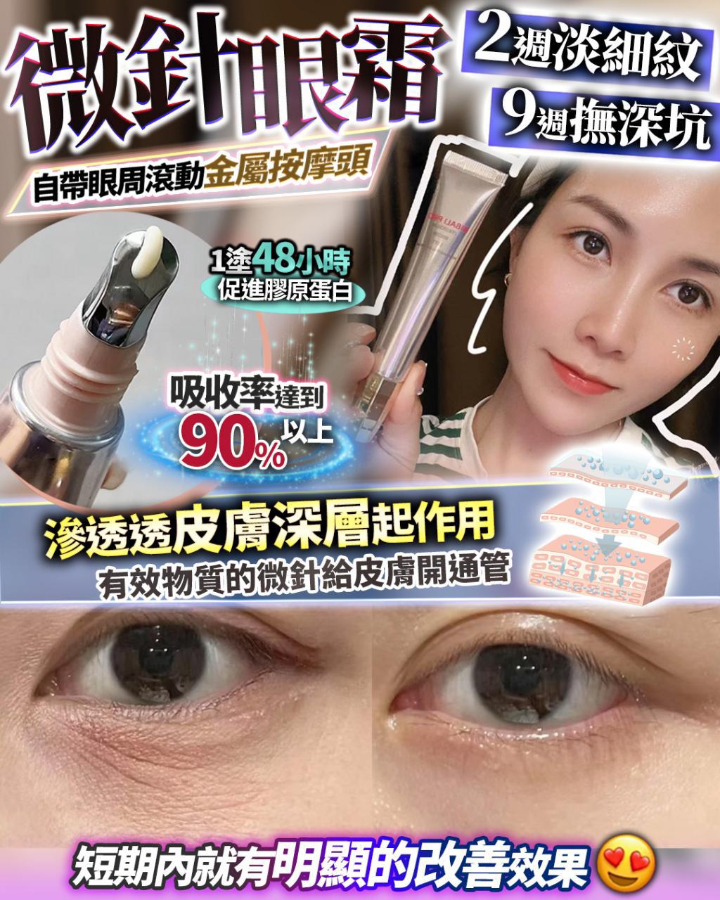 微針眼